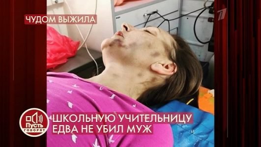 Пусть говорят. Школьную учительницу едва не убил муж (Эфир 13 июля 2021 года